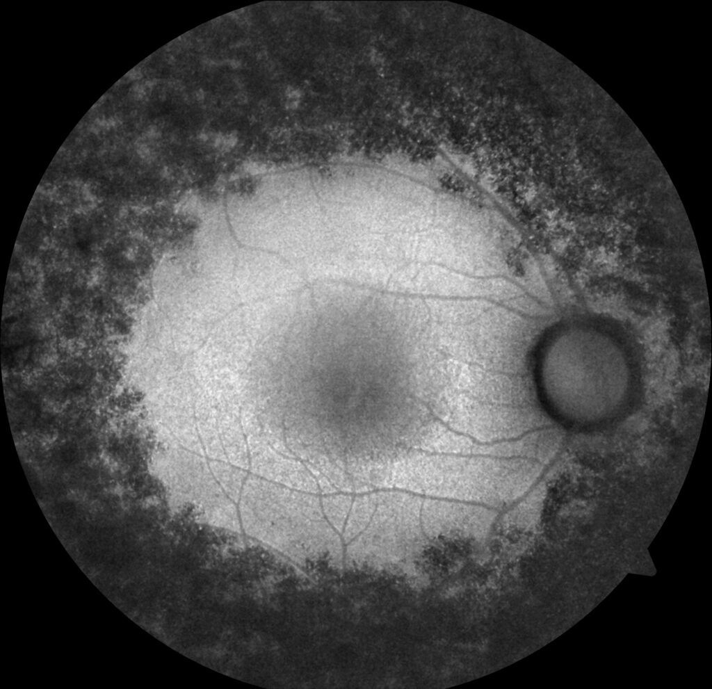 can_burcu_19930101_43822