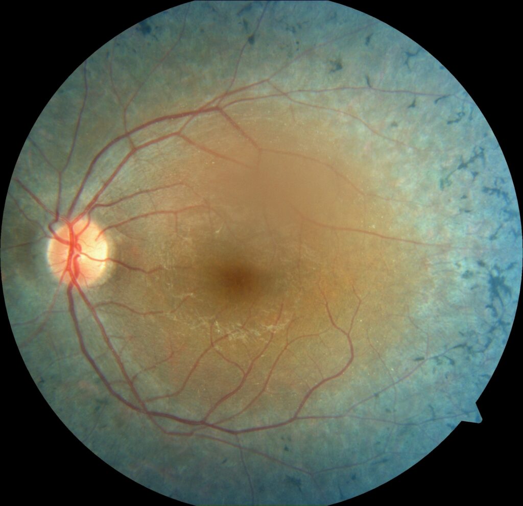 can_burcu_19930101_43901