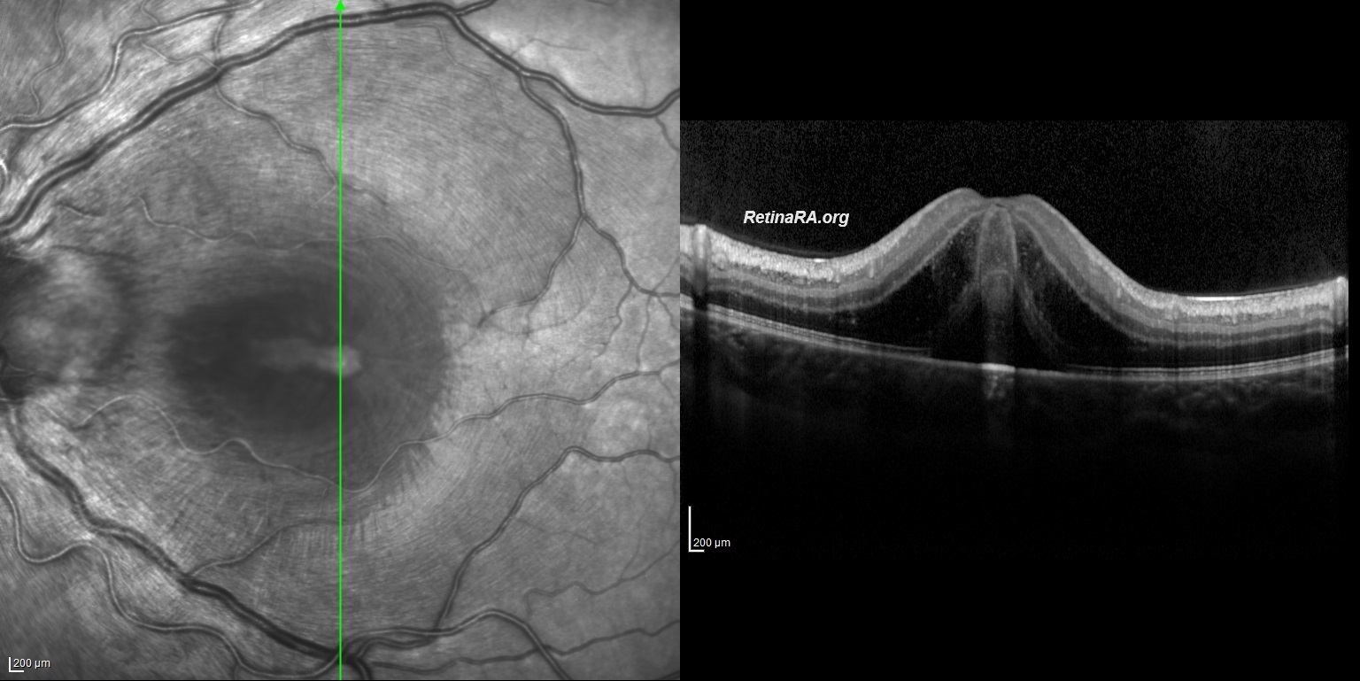 OZANOGLUE-1.-GUN-OCT-1_001qWr0ZD9
