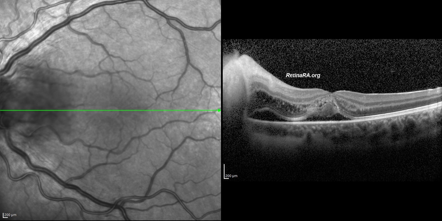 OZANOGLUE-3.-GUN-OCT-1_000