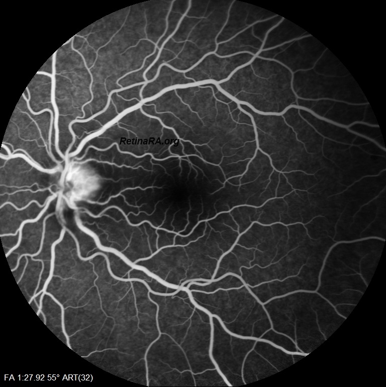 OZANOGLUE-3.GUN-FA_001wtEbGba