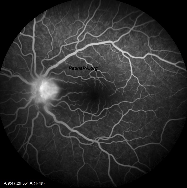 OZANOGLUE-3.GUN-FA_007