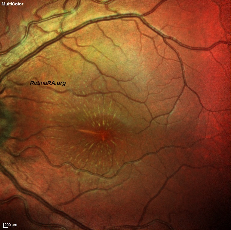 OZANOGLUE-9.-GUN-mc_000