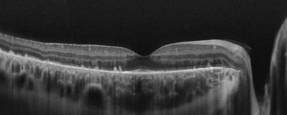 aydogdu_binnur__CZMI1799161423_20090101_Female_HD-1-Line-100x_20211123161542_OD_20230105161410