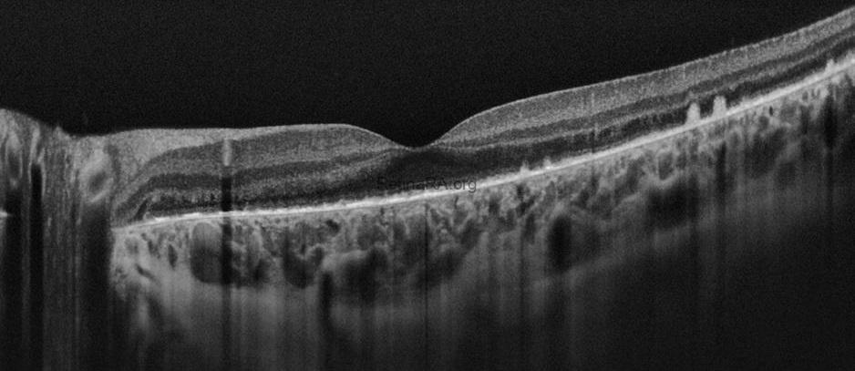 aydogdu_binnur__CZMI1799161423_20090101_Female_HD-1-Line-100x_20211123161751_OS_202301051614229cgrfD0