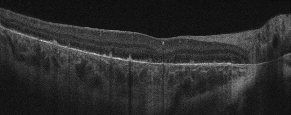 aydogdu_binnur__CZMI1799161423_20090101_Female_HD-21-Line_20211123161700_OD_20230105161250DN6weqX