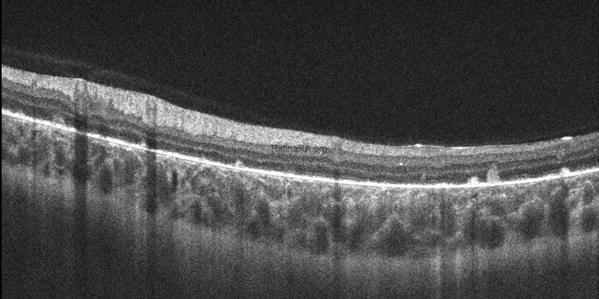 aydogdu_binnur__CZMI1799161423_20090101_Female_HD-21-Line_20211123162011_OS_202301051334019NCWWzX