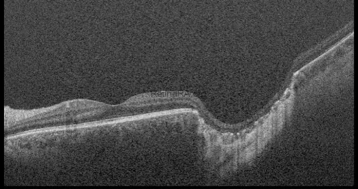 db304d96-9b7e-4f5a-9a80-a3deac9a005fNNPDTAB