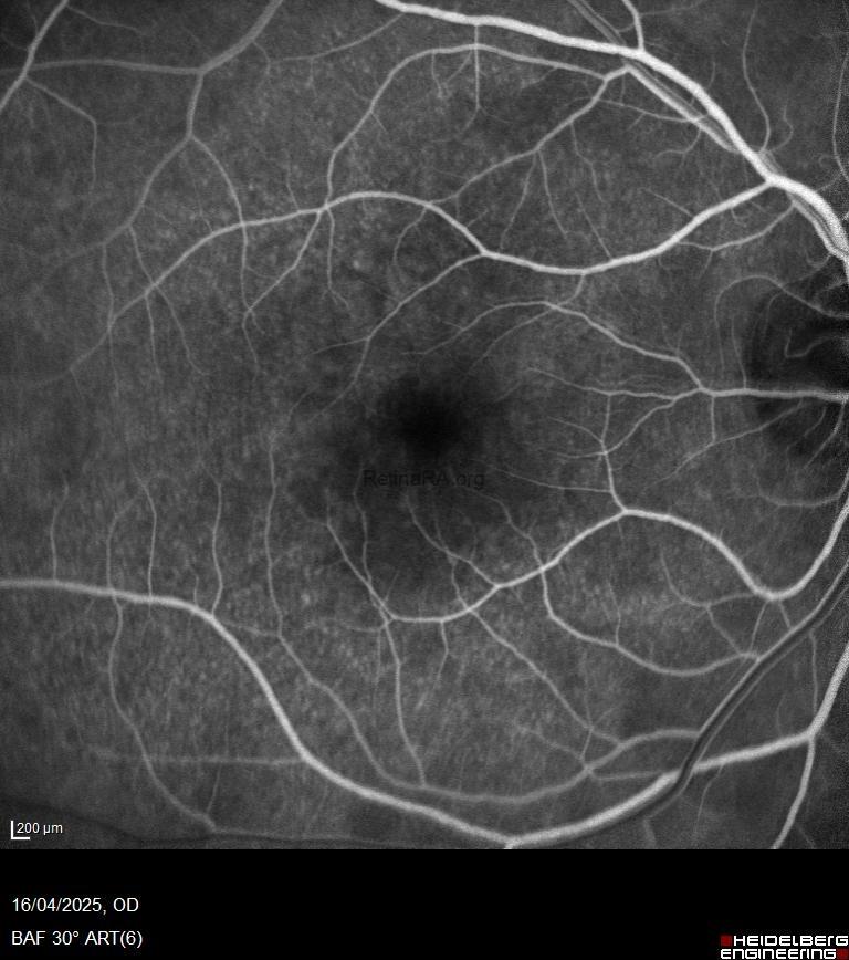 0d5f3a67-0a6b-4b65-8409-ea5b8c481ce1cXfyXl7