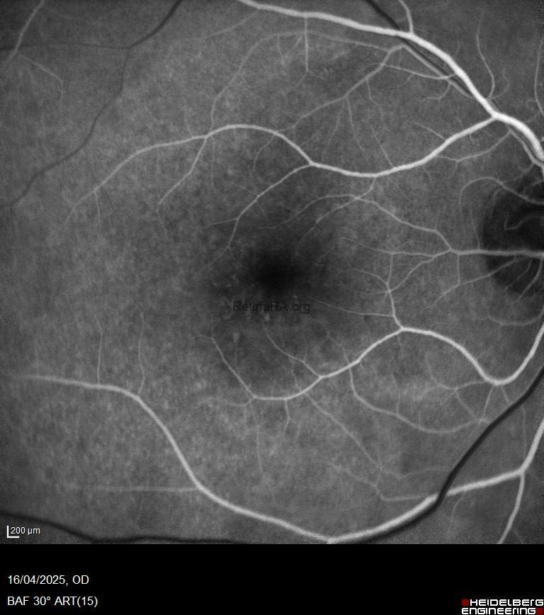 28f2a299-cb27-4d54-8054-f4fd5bb35fa7phdl2LK