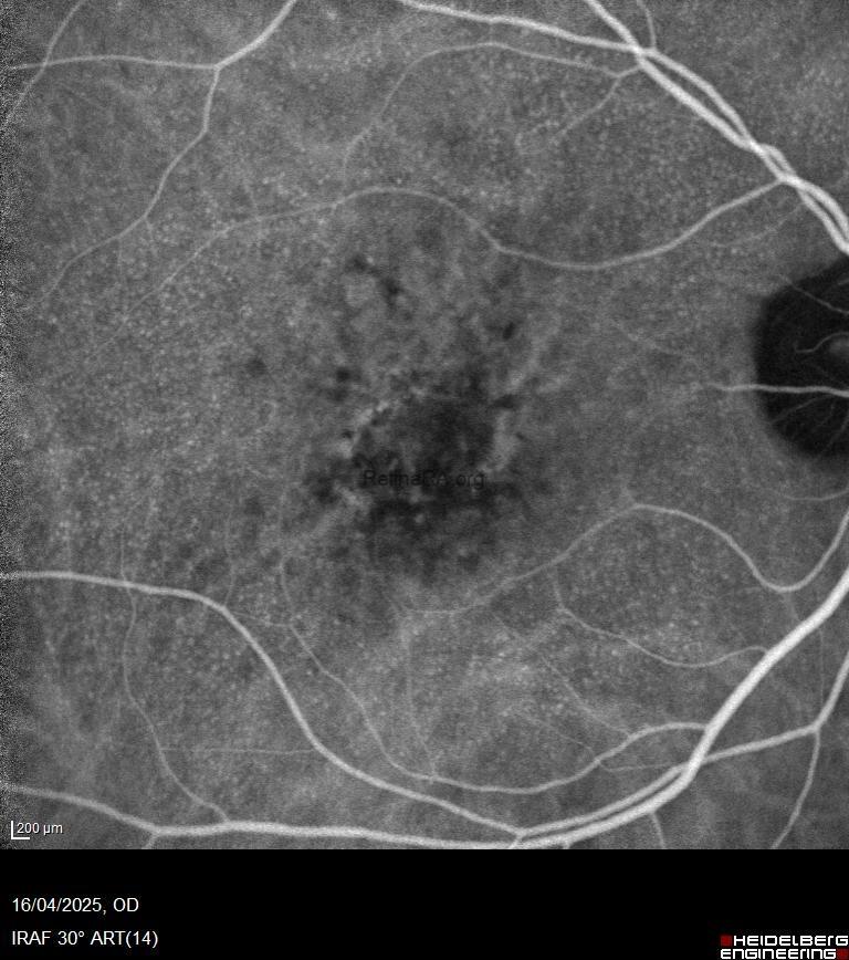 873149ca-0dfa-4bd4-b87d-51271de7ff78Do330BQ