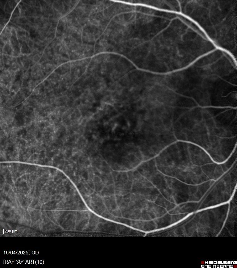 894c0836-6a53-4870-a478-2a6853cc33f7IQZgAvW