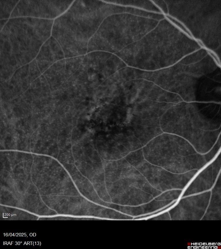 e4a0e7b7-ba12-45d4-bb3d-a611247a6cfa6V2KRM4