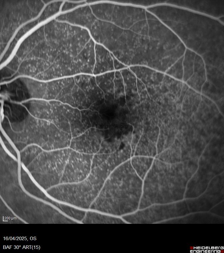 e505f98f-35fa-422b-90c8-58fcbd35e14398rvhAV