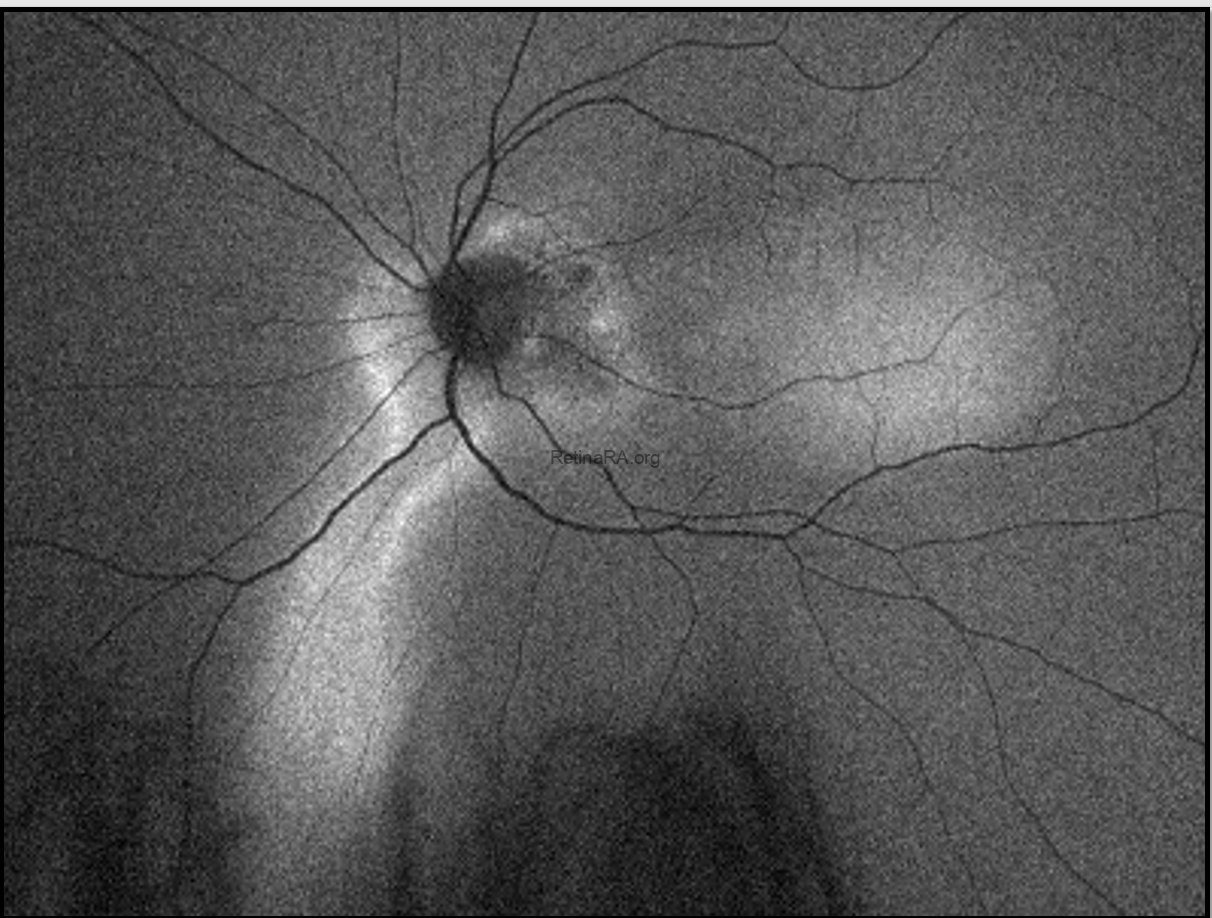 Capture-decran-2026-03-29-a-18.42.55