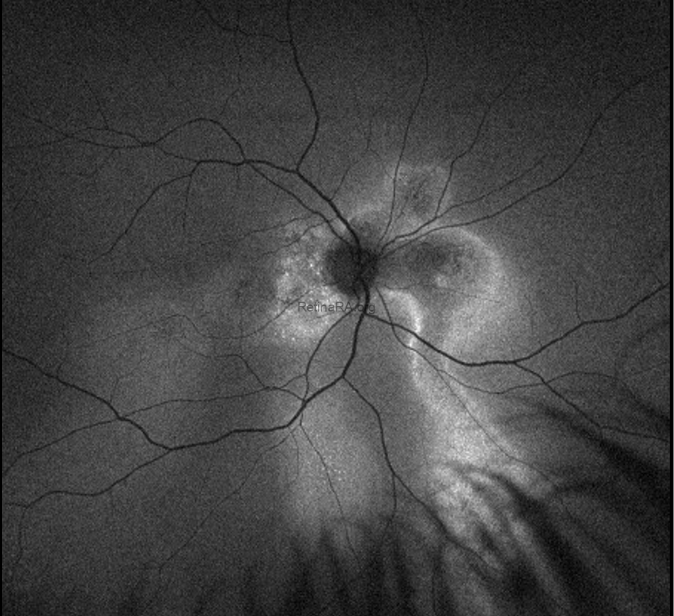 Capture-decran-2026-03-29-a-18.43.14