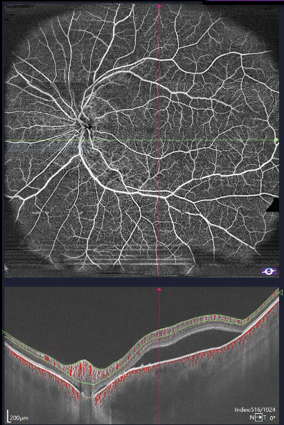 Capture-decran-2026-03-29-a-18.50.59