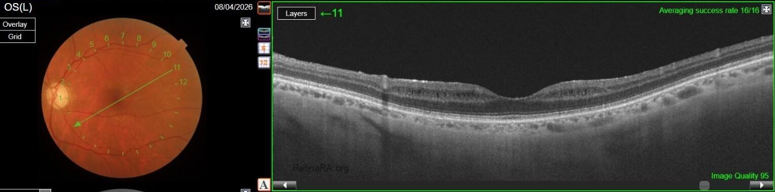 OCT-OS-1-copiatFCoMvL