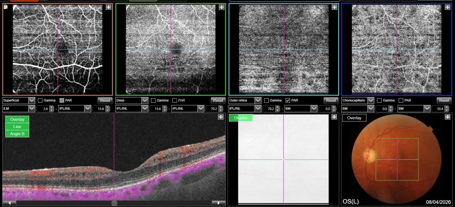 OCTA-OS-1-copia0499Gu1