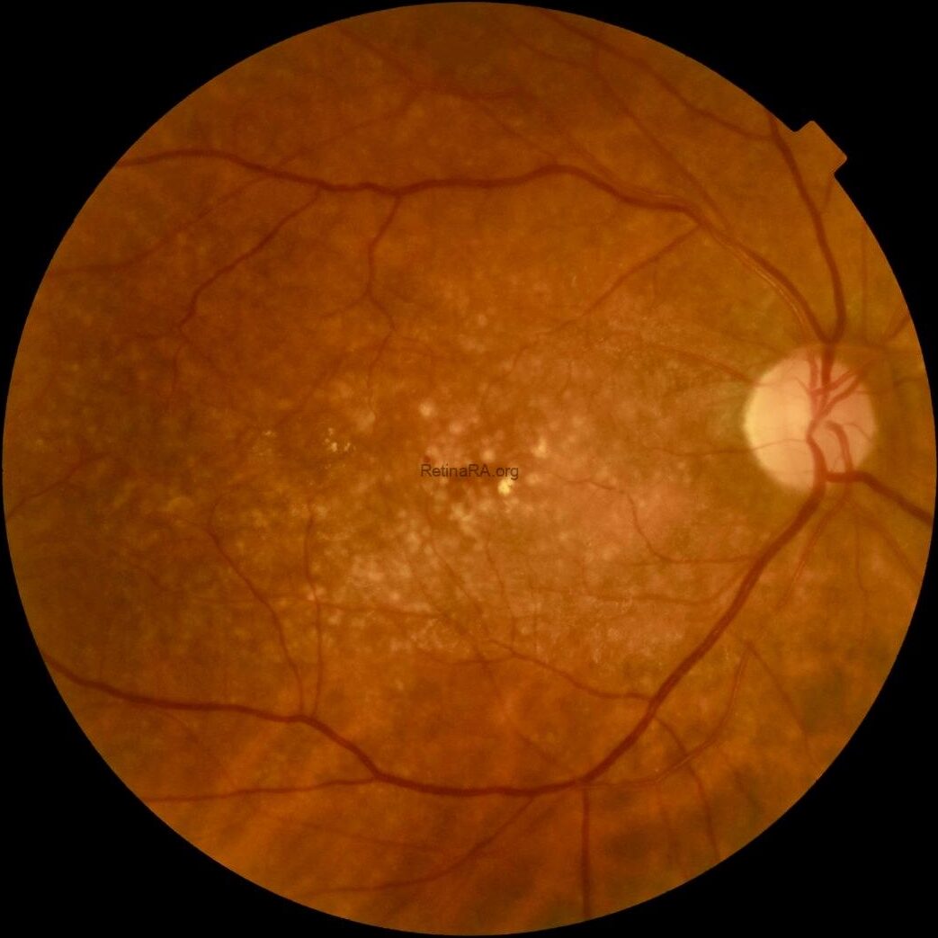 af1bf836-02e9-42b0-995d-76644fe48c4a8zWn2rX